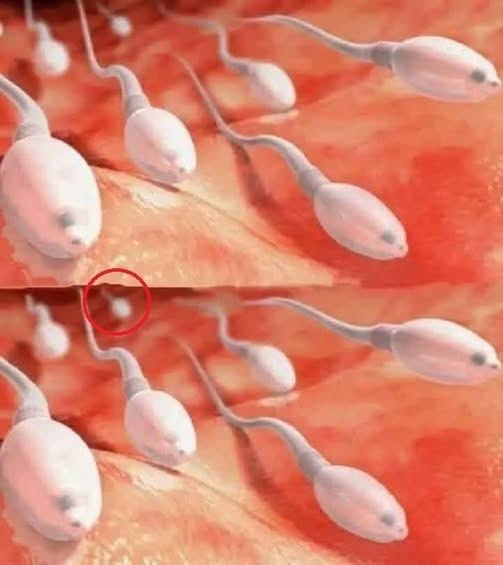 Representación gráfica de espermatozoides