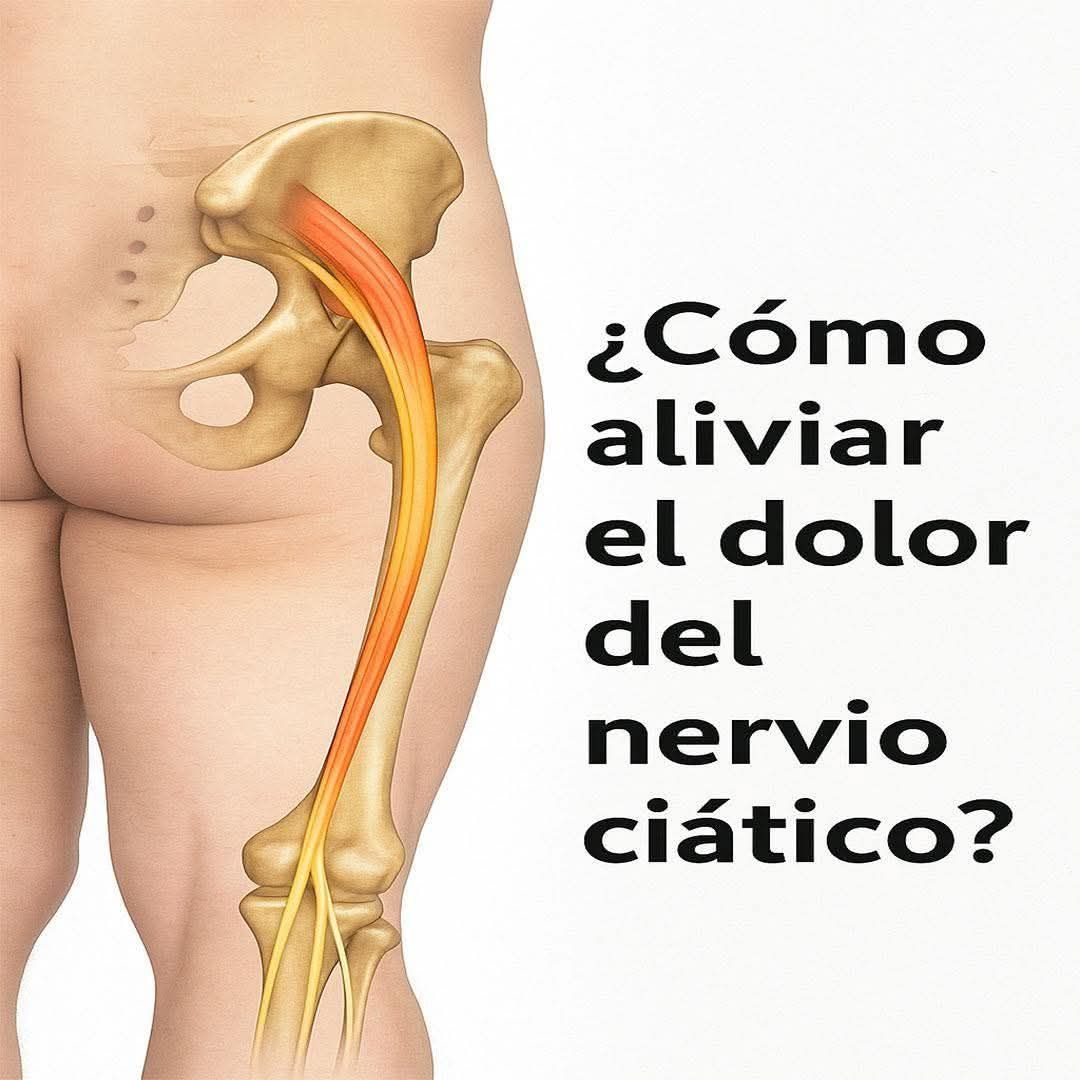 Ilustración del nervio ciático