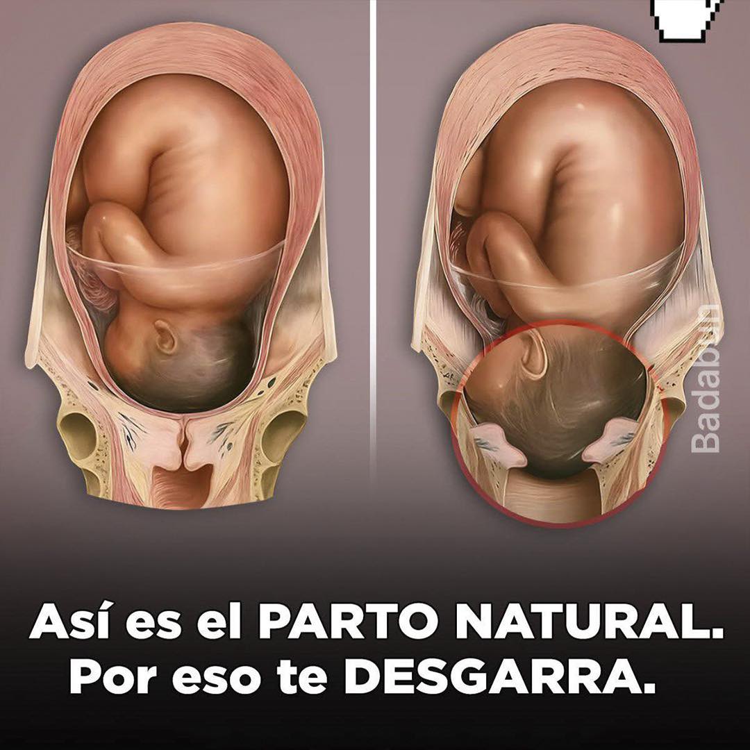 Proceso del Parto Natural