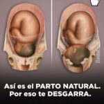 La Experiencia de un Parto Natural Sin Anestesia: Beneficios y Consideraciones