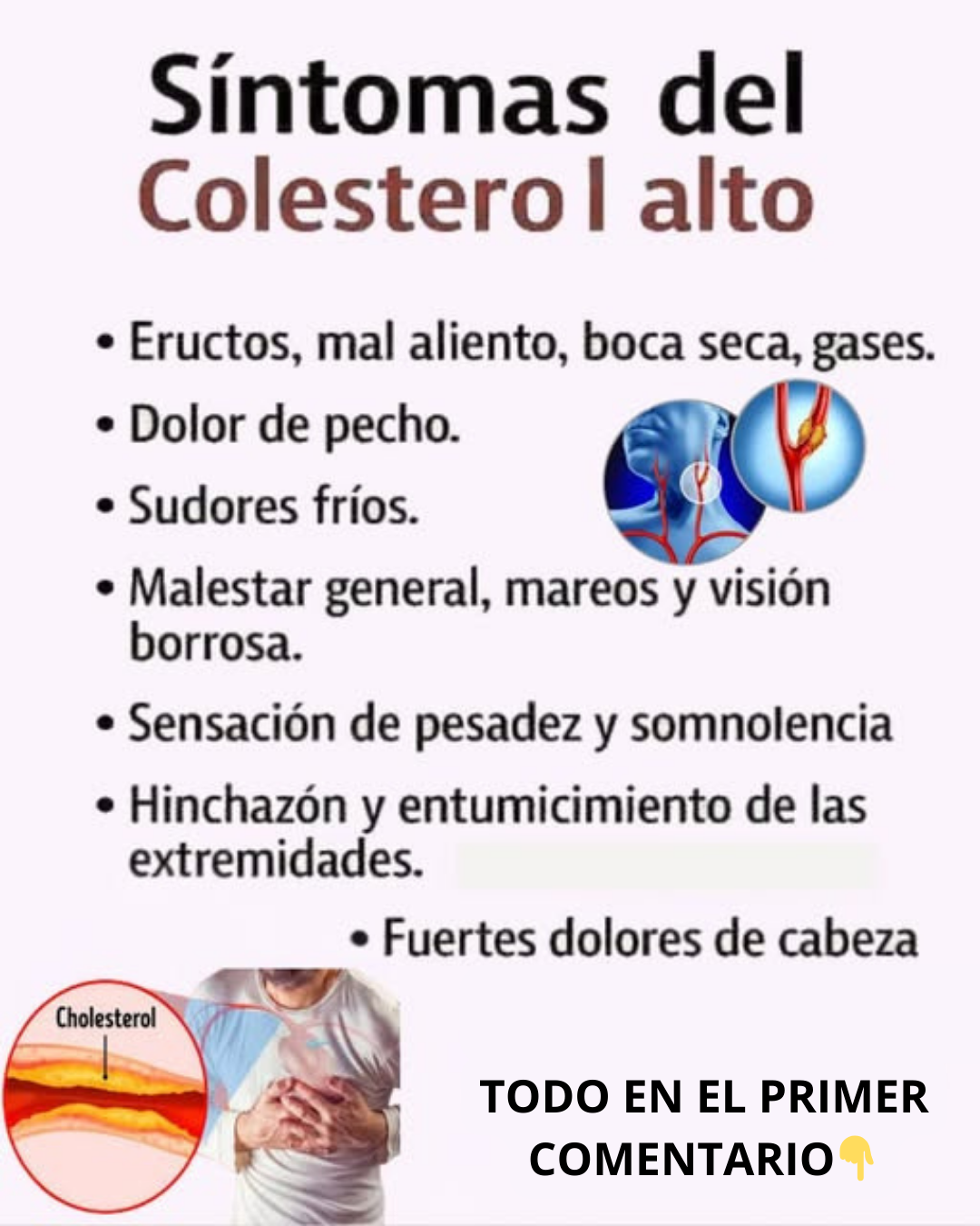 Síntomas del colesterol alto