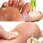 Señales en tus PIES que indican problemas de salud y remedios naturales