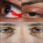 Señales en tus Ojos: ¿Qué Te Están Diciendo?