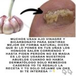 Remedios Caseros para Hongos en las Uñas: Ajo, Vinagre y Bicarbonato