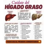 Hígado Graso: Reconocelo y Revierte sus Efectos antes de que sea Tarde