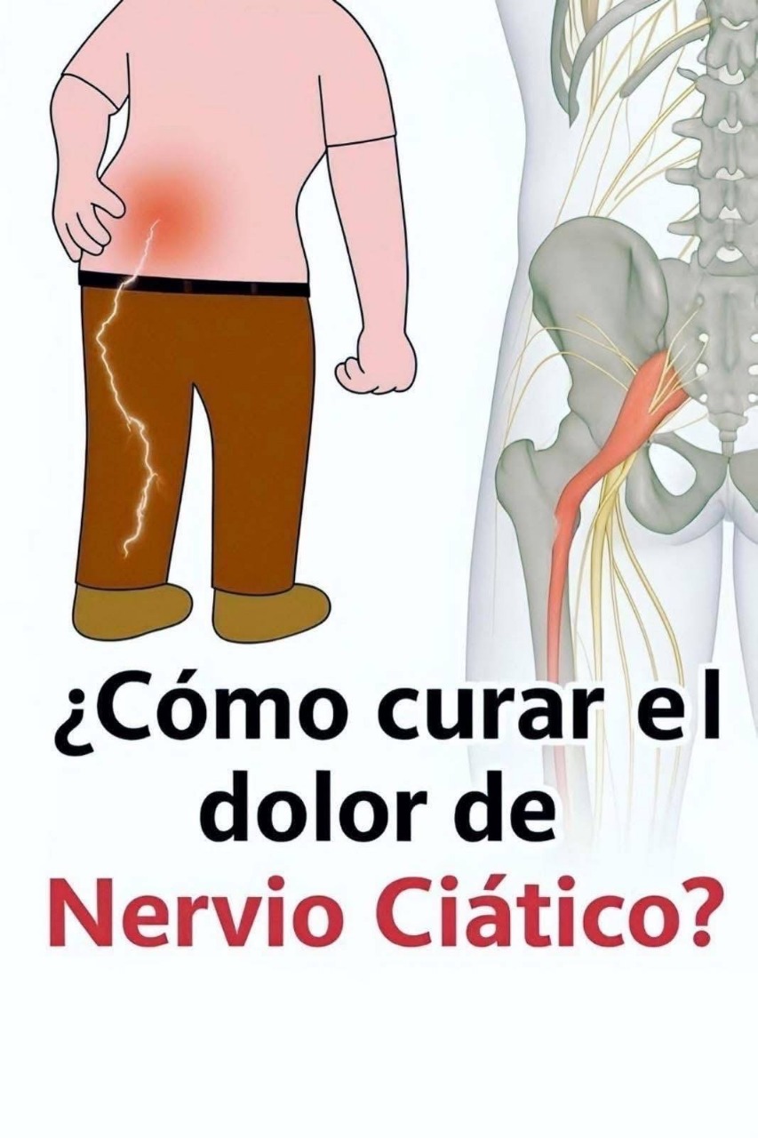 Dolor del Nervio Ciático