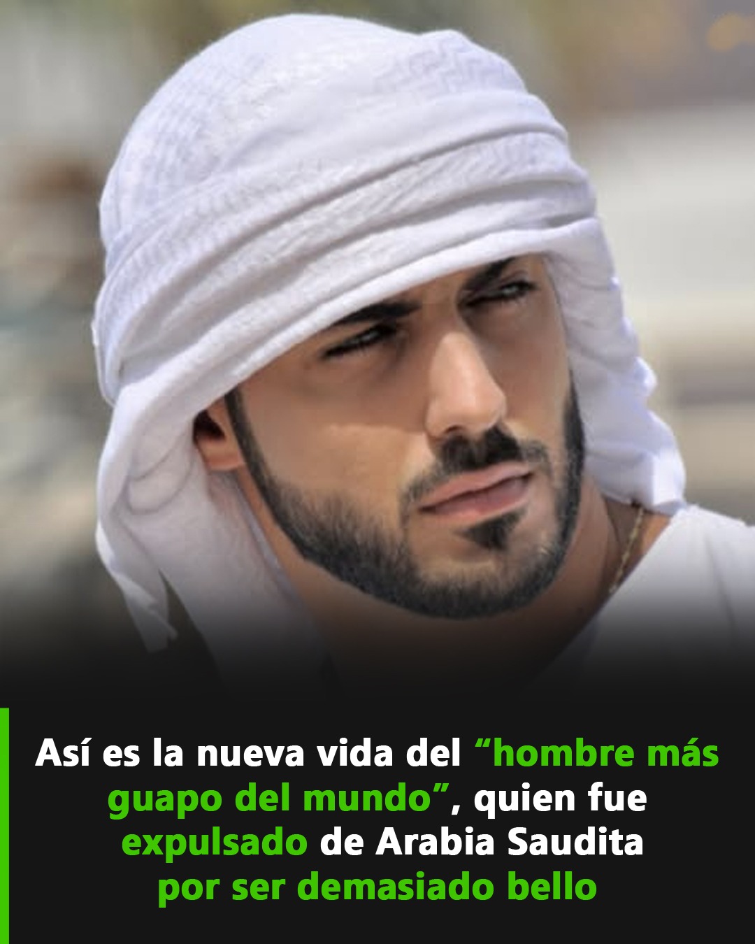 El hombre más guapo del mundo en su nueva vida
