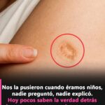La Cicatriz de la Infancia: Significado y Salud Detrás de la Vacuna BCG