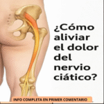 Cómo Aliviar el Dolor del Nervio Ciático: Remedios Naturales y Consejos Prácticos
