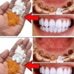 Descubre el Blanqueamiento Dental Casero: Resultados Asombrosos en Solo 2 Minutos