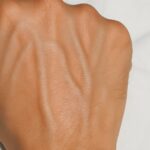 Alteraciones en las Venas de las Manos: Signos y Remedios Naturales