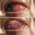 Las Consecuencias de Dormir con Maquillaje: Salud Ocular y Consejos