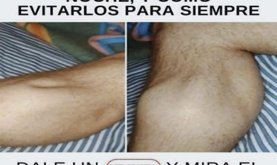 Calambres en las Piernas: Esta Podría Ser la Razón, y Te Sorprenderá