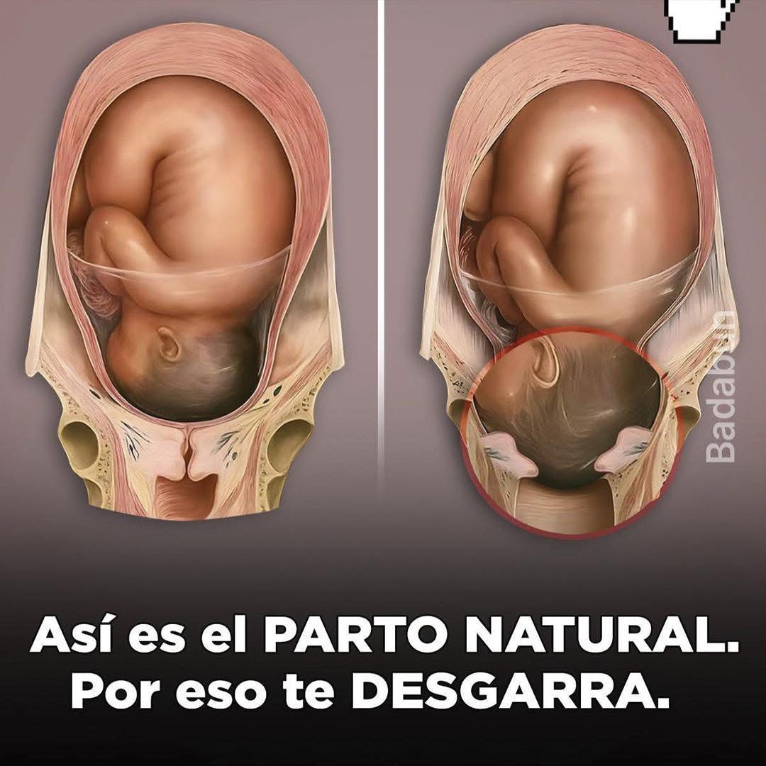 Proceso de Parto Natural