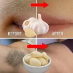 Cómo Eliminar el Vello Facial, Corporal y Púbico de Forma Natural con Ajo