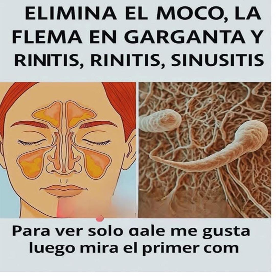 Remedios naturales para la congestión nasal