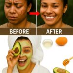 Di Adiós a los Puntos Negros con Solo un Huevo: ¡Descubre Este Tratamiento Natural!