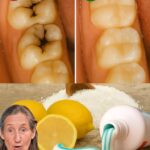 Cómo Reparar una Cavidad de Forma Natural: Consejos y Remedios Efectivos