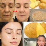 Potente Tratamiento Natural: Gel de Papa Para Eliminar Manchas Oscuras en la Piel