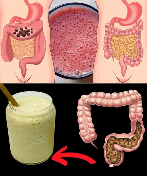 Comparación de intestinos antes y después de un batido natural