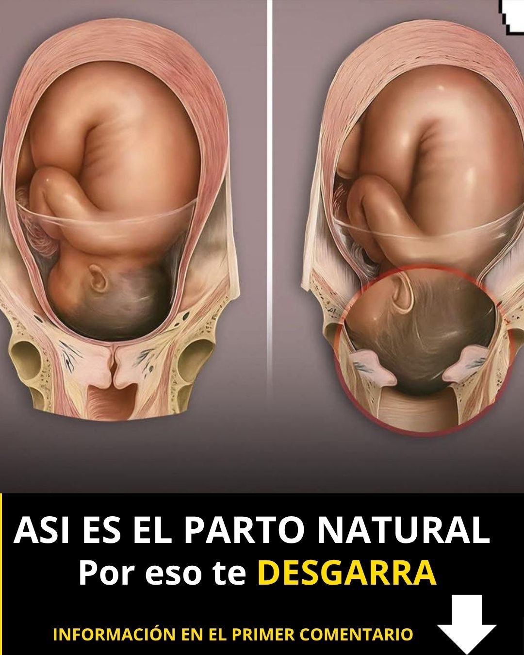 Ilustración médica del proceso de parto natural