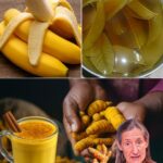 Remedios Naturales para Mejorar tu Salud: Beneficios de la Cúrcuma, Bananas y Más