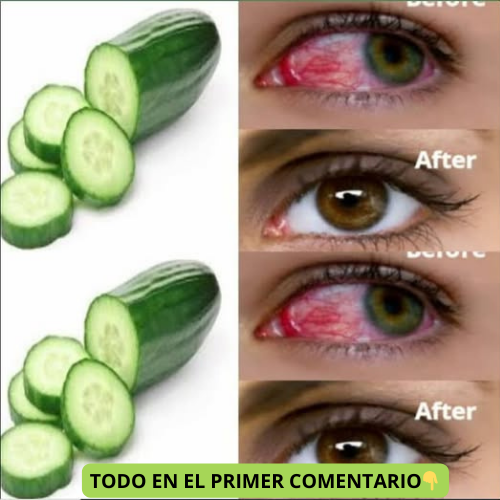 Antes y Después de Usar Pepino en los Ojos