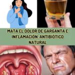 MATA EL DOLOR DE GARGANTA E INFLAMACIÓN: ¡ANTIBIÓTICO NATURAL!