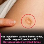 ¿Tienes una Marca Redonda en el Brazo? El Significado Histórico que Muchos Ignoran