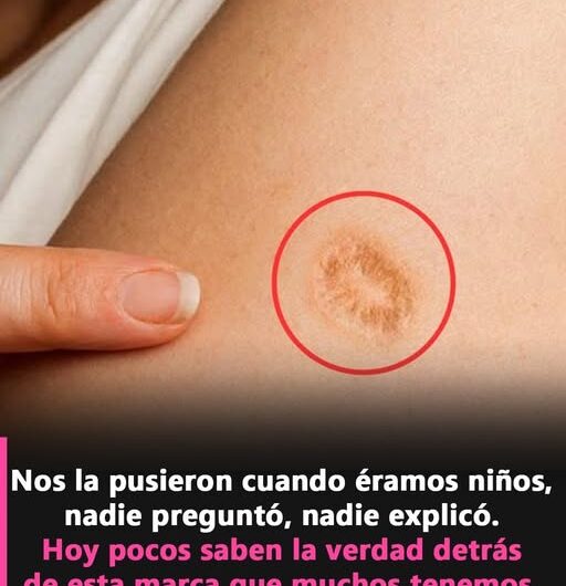 ¿Tienes una Marca Redonda en el Brazo? El Significado Histórico que Muchos Ignoran