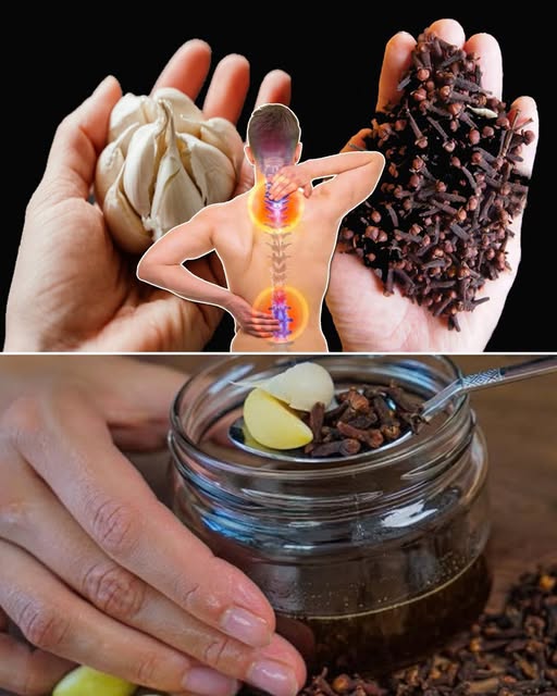 Remedios naturales con ajo y clavo