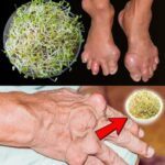 Elimina los Cálculos Renales y la Gota de Forma Natural con Brotes Verdes