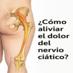 Descubre Cómo Aliviar el Dolor del Nervio Ciático de Forma Natural