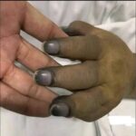 Salud y Belleza: Riesgos de Pintarse las Uñas