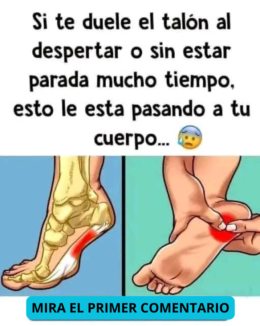 Anatomía del pie con enfoque en la fascitis plantar