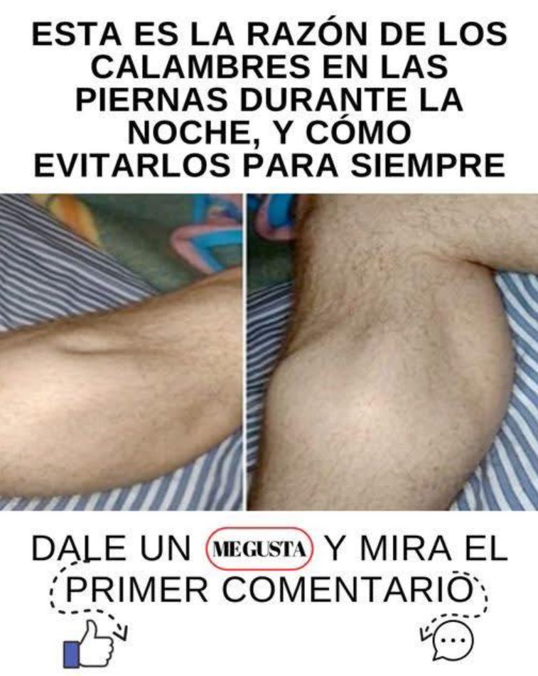 Calambres en las piernas