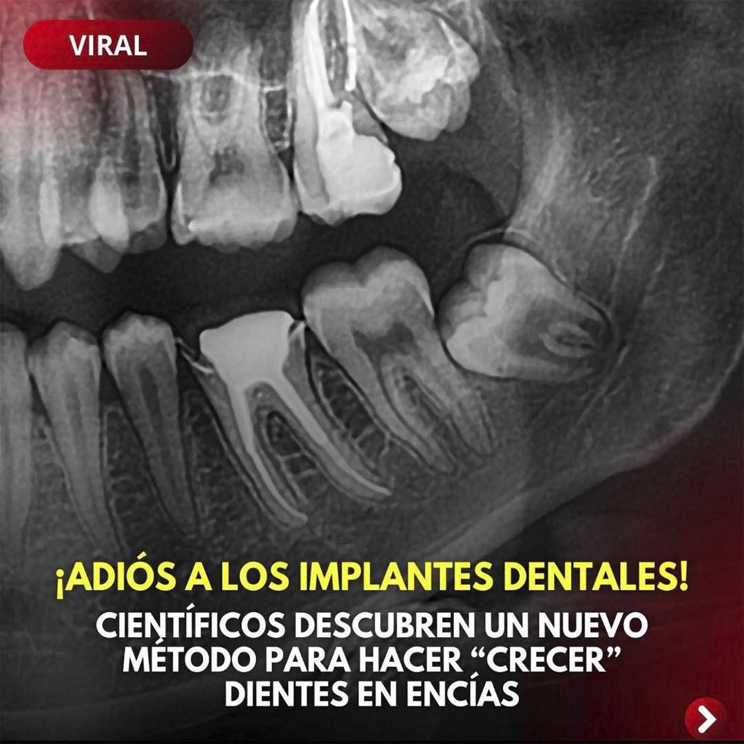 Radiografía Dental del Nuevo Método