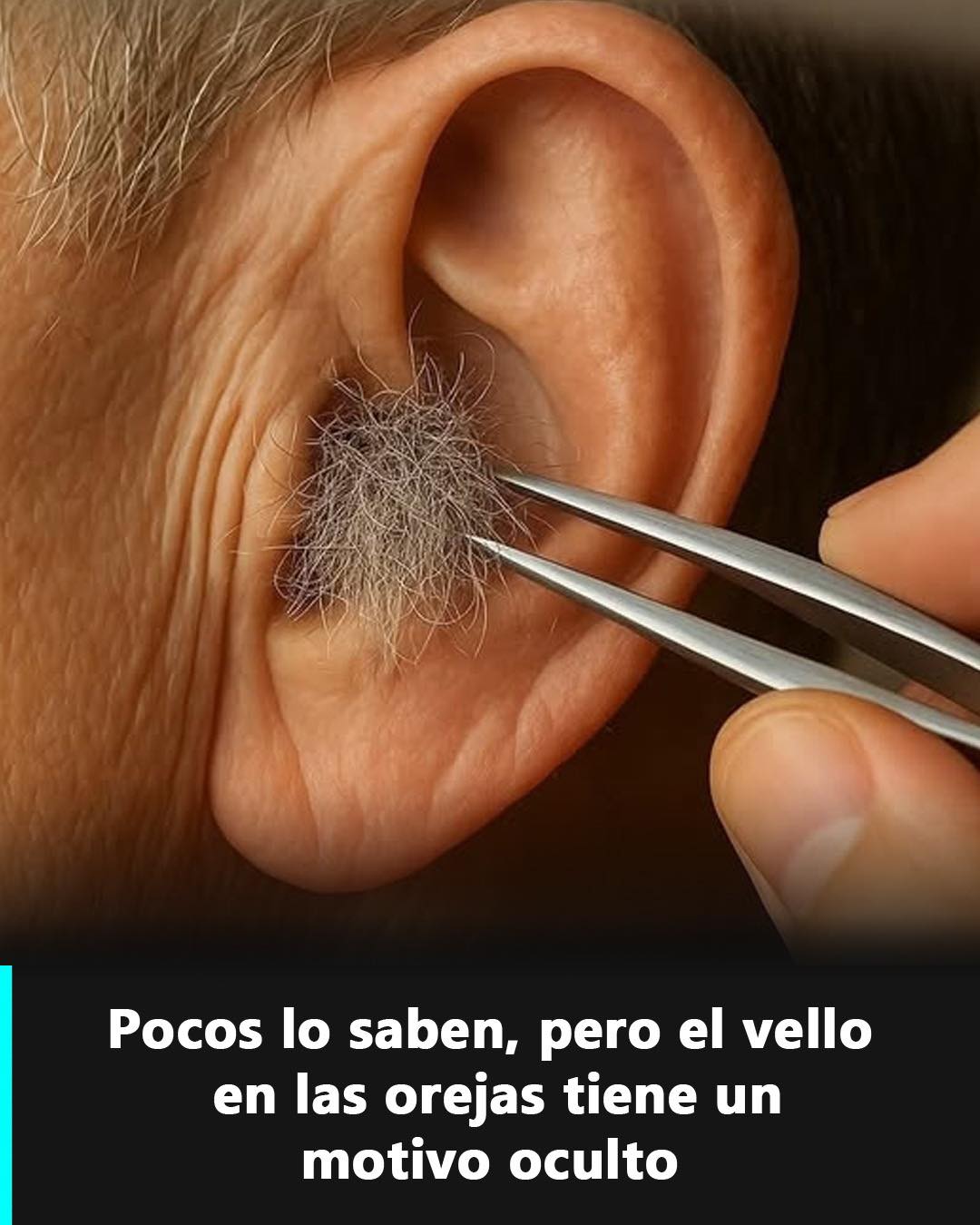 Vello en el oído