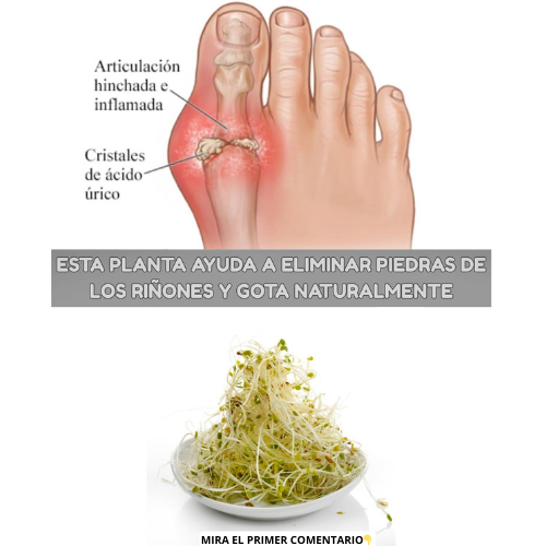 Planta que ayuda a eliminar piedras de los riñones y la gota