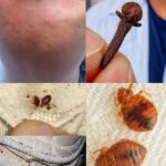 Cómo Identificar y Combatir las Chinches en Tu Hogar: Guía Práctica de Remedios Naturales