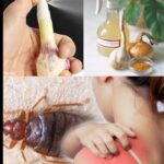 Adiós Chinches: El Poder del Ajo y Otros Remedios Naturales