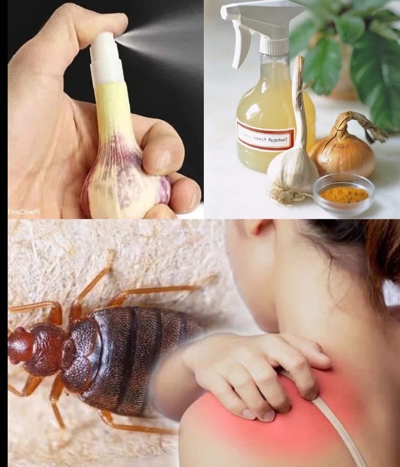 Remedios naturales contra chinches