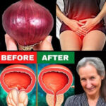 Remedios Naturales: Revitaliza tu Vejiga y Próstata con Cebolla Morada