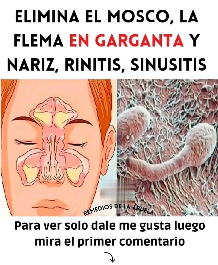 Ilustración de los senos paranasales