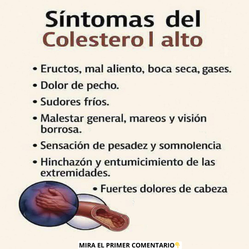 Síntomas del Colesterol Alto
