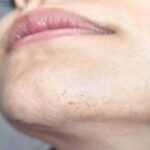 Señales de que tu cuerpo necesita atención: Remedios Naturales para el Bienestar Femenino