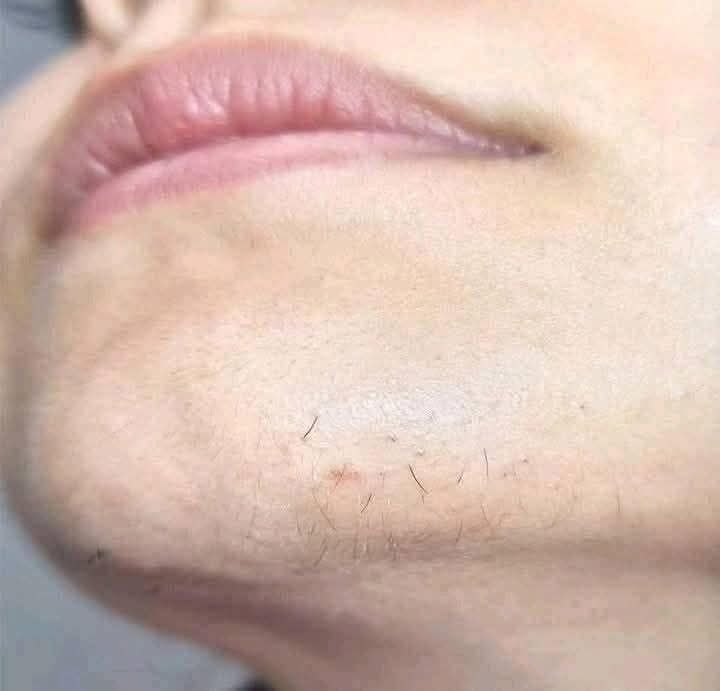 Cuidado personal y vello facial