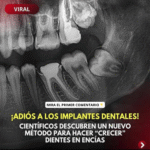¡Adiós a los implantes dentales! Avances en la regeneración de dientes