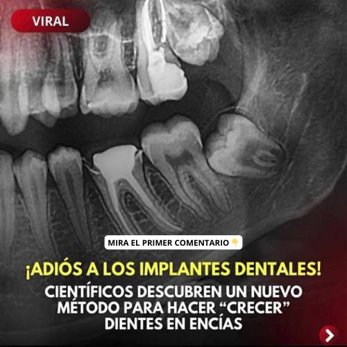 Radiografía dental