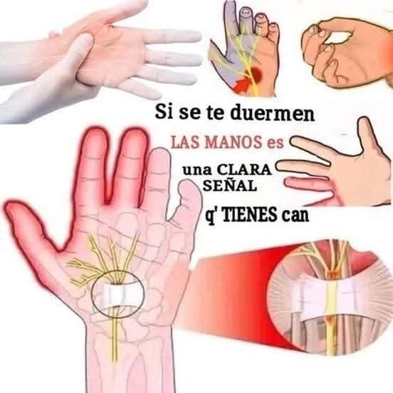 Salud de las manos
